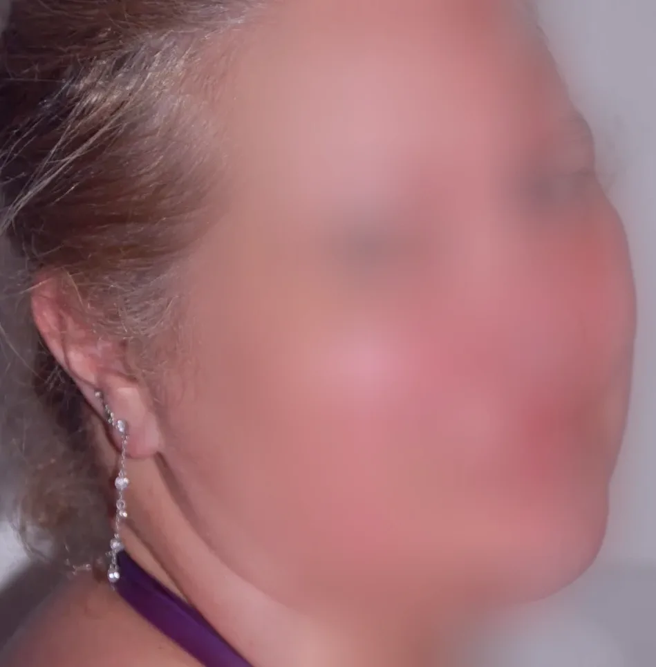 Aleyna, 28